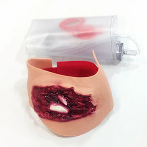 Simulaids Crushed Foot