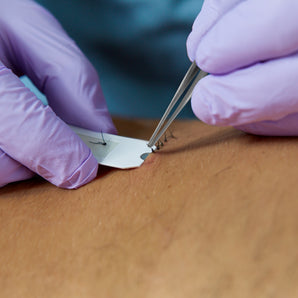 Suture Removal Tool